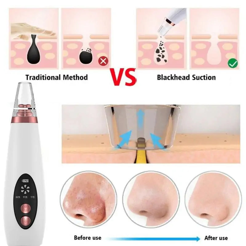 Rechargeable Electric Blackhead remover