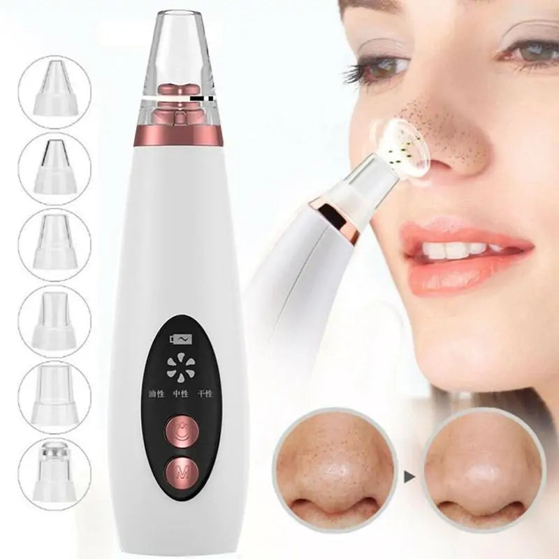 Rechargeable Electric Blackhead remover