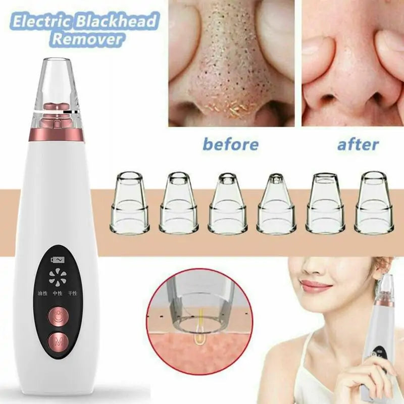 Rechargeable Electric Blackhead remover